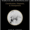 Vascular Anomalies: Classification, Diagnosis, and Management