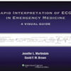 Rapid Interpretation of ECGs in Emergency Medicine: A Visual Guide