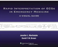 Rapid Interpretation of ECGs in Emergency Medicine: A Visual Guide