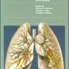 Manual of Clinical Problems in Pulmonary Medicine (Lippincott Manual Series (Formerly known as the Spiral Manual Series)) Sixth Edition