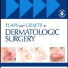 Flaps and Grafts in Dermatologic Surgery: Text