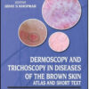 Dermoscopy and Trichoscopy in Diseases of the Brown Skin: Atlas and Short Text