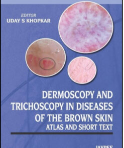 Dermoscopy and Trichoscopy in Diseases of the Brown Skin: Atlas and Short Text