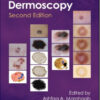 An Atlas of Dermoscopy, 2nd Edition