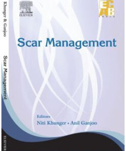 Scar Management – ECAB