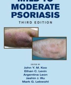 Mild to Moderate Psoriasis, Third Edition