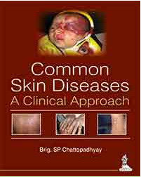 Common Skin Diseases—A Clinical Approach