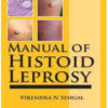 Manual of Histoid Leprosy