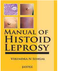 Manual of Histoid Leprosy