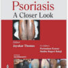 Psoriasis: A Closer Look 1st Edition