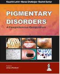 Pigmentary Disorders: A Comprehensive Compendium