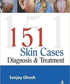 151 Skin Cases: Diagnosis and Treatment
