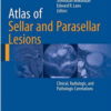 Atlas of Sellar and Parasellar Lesions: Clinical, Radiologic, and Pathologic Correlations 1st ed. 2016 Edition