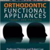 Orthodontic Functional Appliances: Theory and Practice 1st Edition