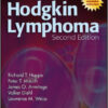 Hodgkin Lymphoma, 2nd Edition