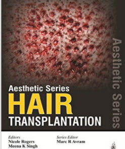 Hair Transplantation (Aesthetic) 1st Edition