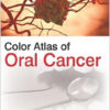 Free Color Atlas of Oral Cancer 1st Edition