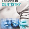 Free Mucocutaneous Lesions in Dentistry 1st Edition