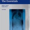 Spinal Deformities: The Essentials 2nd edition Edition by Robert F. Heary