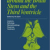 Surgery in and around the Brain Stem and the Third Ventricle: Anatomy · Pathology · Neurophysiology Diagnosis · Treatment