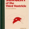 Surgery of the Third Ventricle Second Edition
