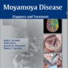 Moyamoya Disease: Diagnosis and Treatment – Original PDF + Videos