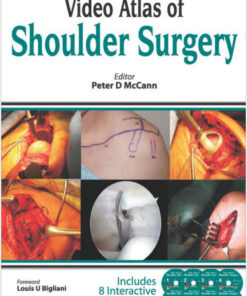 8 DVD VIDEOS  Atlas of Shoulder Surgery
