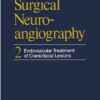Surgical Neuroangiography: 2 Endovascular Treatment of Craniofacial Lesions