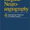 Surgical Neuroangiography: 4 Endovascular Treatment of Cerebral Lesions