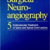 Surgical Neuroangiography: Endovascular Treatment of the Spine and Spinal Cord Lesions 1st Edition