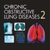 Chronic Obstructive Lung Disease 2nd Edition