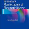Pulmonary Manifestations of Rheumatic Disease: A Comprehensive Guide 2014th Edition