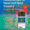 Radiotherapy for Head and Neck Cancers: Indications and Techniques Fourth Edition