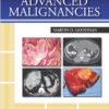 Regional Therapeutics for Advanced Malignancies 1st Edition
