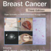 Early Breast Cancer: From Screening to Multidisciplinary Management, Third Edition 3rd Edition