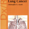 Dx/Rx: Lung Cancer (Jones and Bartlett Publishers DX/RX Oncology) 1st Edition
