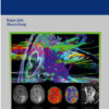 Brain Tumor Imaging 1st Edition