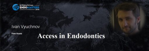 Video Access in Endodontics - Ivan Vyuchnov