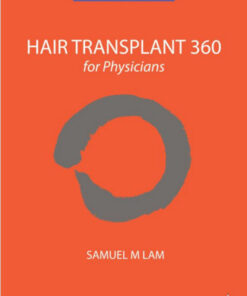Hair Transplant 360 for Physicians 2  Edition