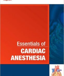 Essentials of Cardiac Anesthesia: A Volume in Essentials of Anesthesia and Critical Care