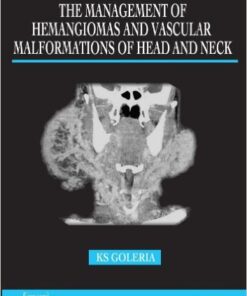 The Management of Hemangiomas and Vascular Malformations of Head and Neck