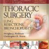 Master Techniques in Surgery: Thoracic Surgery: Lung Resections, Bronchoplasty 1st Edition
