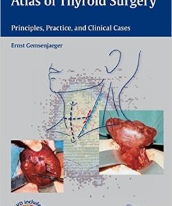 Atlas of Thyroid Surgery: Principles, Practice, and Clinical Cases – Book and DVD