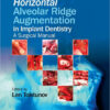 Horizontal Alveolar Ridge Augmentation in Implant Dentistry: A Surgical Manual 1st Edition
