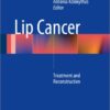 Lip Cancer: Treatment and Reconstruction 2014th Edition