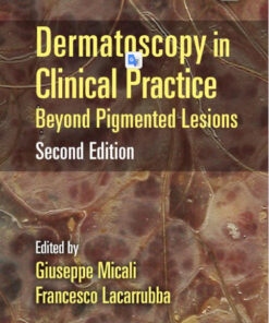 Dermatoscopy in Clinical Practice, Second Edition: Beyond Pigmented Lesions (Series in Dermatological Treatment) 2nd Edition