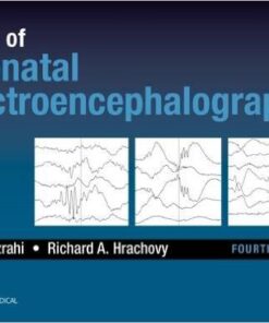 Atlas of Neonatal Electroencephalography, Fourth Edition 4th Edition