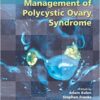 Current Management of Polycystic Ovary Syndrome  1st Edition
