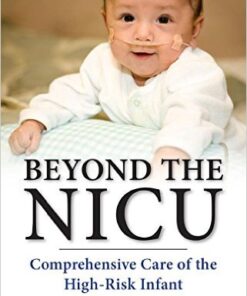 Beyond the NICU: Comprehensive Care of the High-Risk Infant 1st Edition