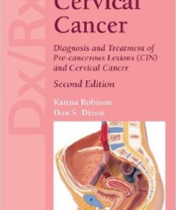 Dx/Rx: Cervical Cancer 2nd Edition